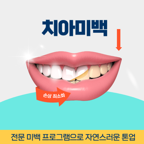 하남치과 하남시 치과 치아미백