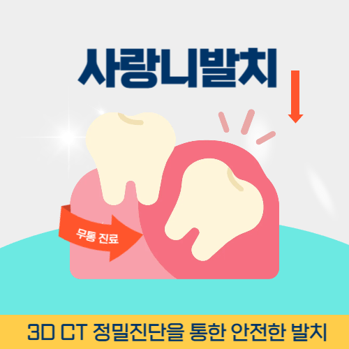 하남치과 하남시 치과 사랑니 발치